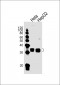 PPT1 Antibody